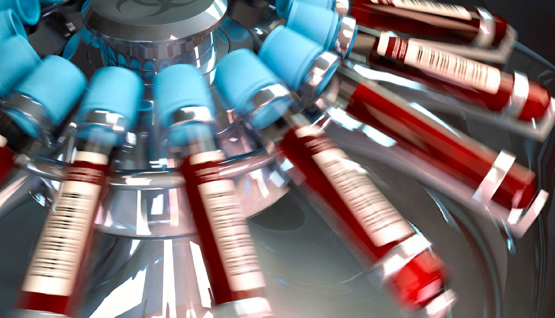 Hemograma completo: En qué consiste y cuándo se debe solicitar.