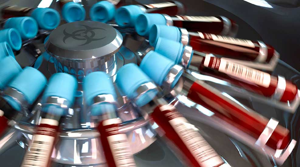 ¿Por qué me pidieron repetir el examen de laboratorio?