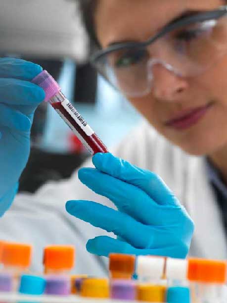 Laboratorio San Andrés – Lo que tu sangre puede revelar antes de que aparezcan síntomas.