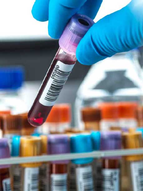 Laboratorio San Andrés – ¿Cuándo un examen puede ser una señal de alerta real?.