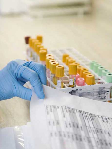 Laboratorio San Andrés – Interpretación de resultados: lo que realmente significa “estar fuera de rango”..