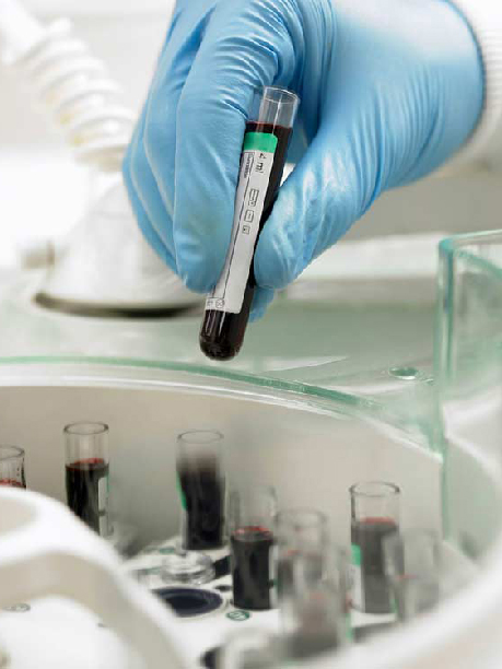 Laboratorio San Andrés – ¿Qué tan confiables son los exámenes de laboratorio?..